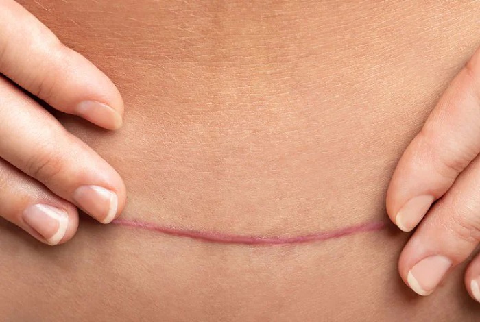 AVS PLASTIC SURGERY AND SKIN CLINIC Pudukkottai